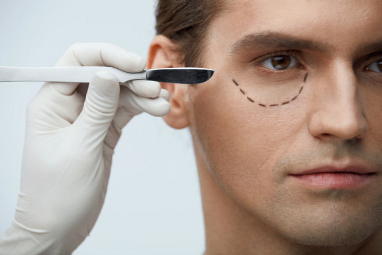 What Should You Expect From Eyelid Surgery?