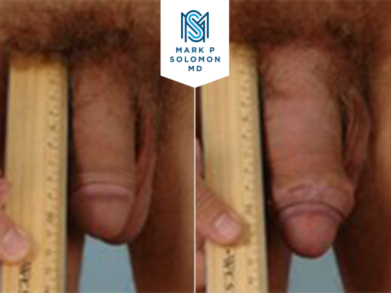Patient 4 &mdash; before and after