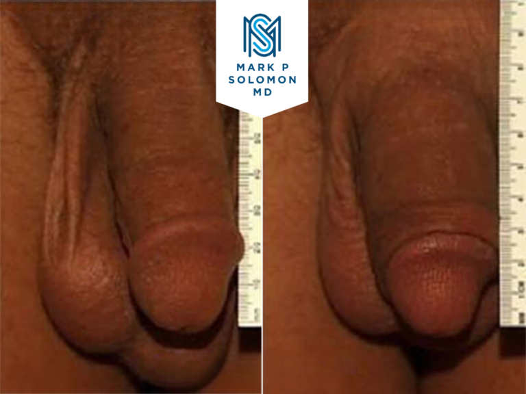 Patient 2 &mdash; before and after