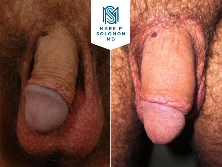 Patient 3 &mdash; before and after