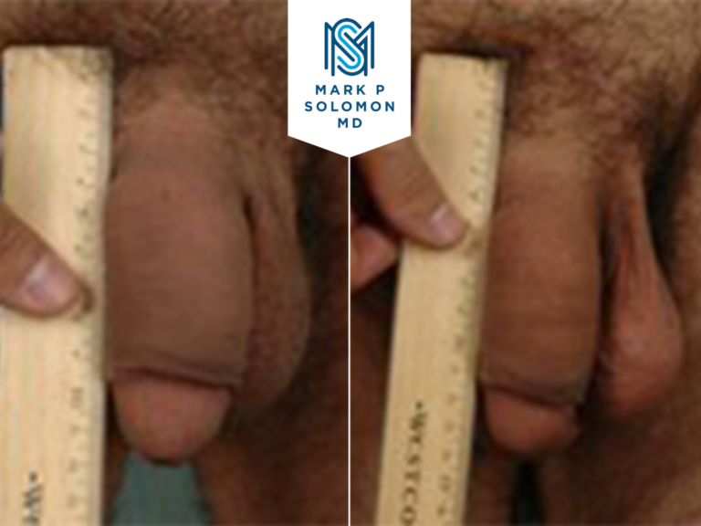 Patient 5 &mdash; before and after