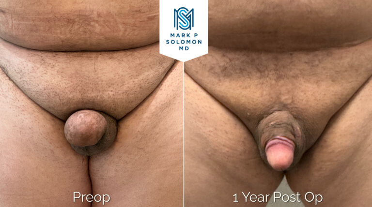 Patient 2 &mdash; before and after