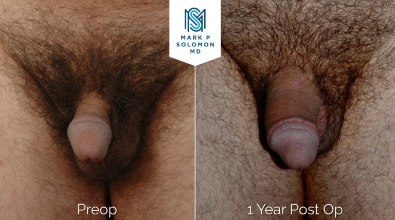 Patient 4 &mdash; before and after