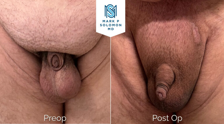 Patient 3 &mdash; before and after