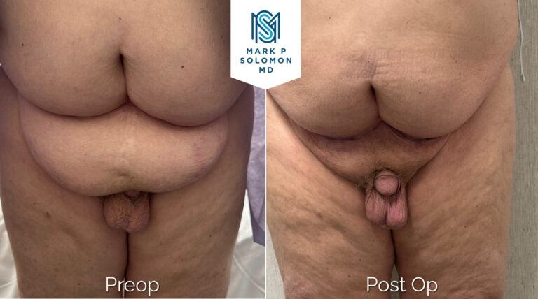 Patient 4 &mdash; before and after