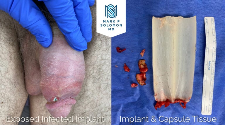 Patient 2 &mdash; before and after