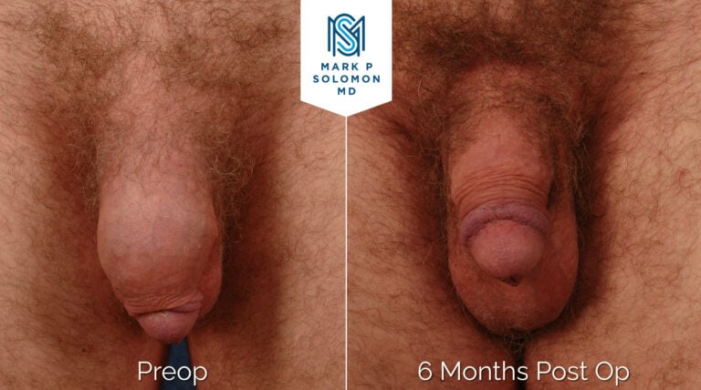 Patient 3 &mdash; before and after
