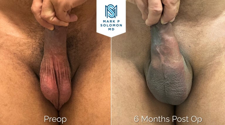 Patient 2 &mdash; before and after