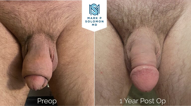 Patient 2 &mdash; before and after