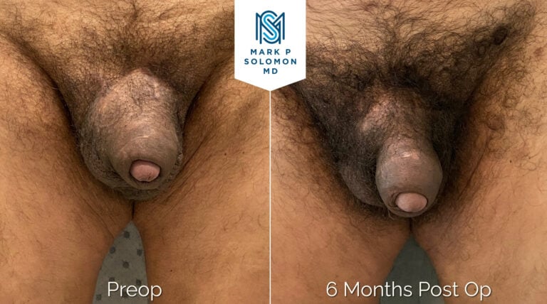 Patient 3 &mdash; before and after